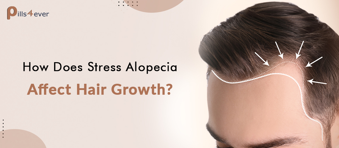 How Does Stress Alopecia Affect Hair Growth?