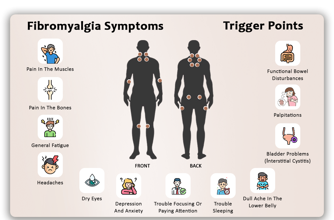 fibromyalgia symptoms