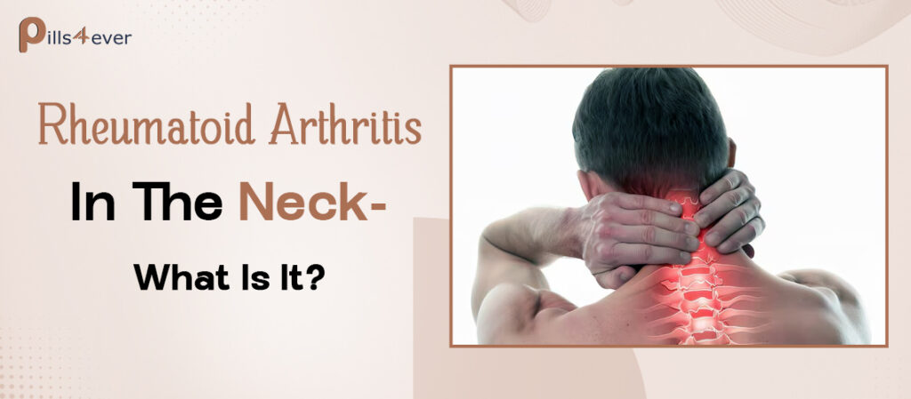 Rheumatoid arthritis (RA) of the neck, also known as cervical spine rheumatoid arthritis, is a condition where the inflammation from rheumatoid arthritis (RA) affects the joints
